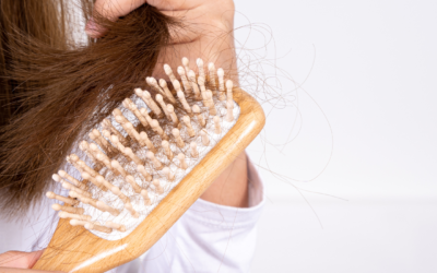 La chute de cheveux